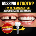 Permanent Tooth Replacement Auburn Maine | Implants, Bridges & Dentures