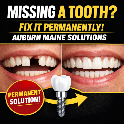 Permanent Tooth Replacement Auburn Maine | Implants, Bridges & Dentures